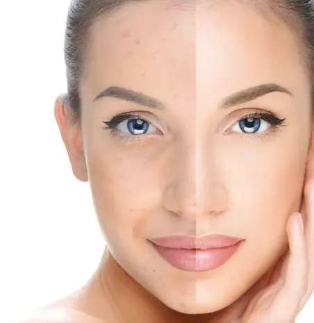 Treatment BB Glow