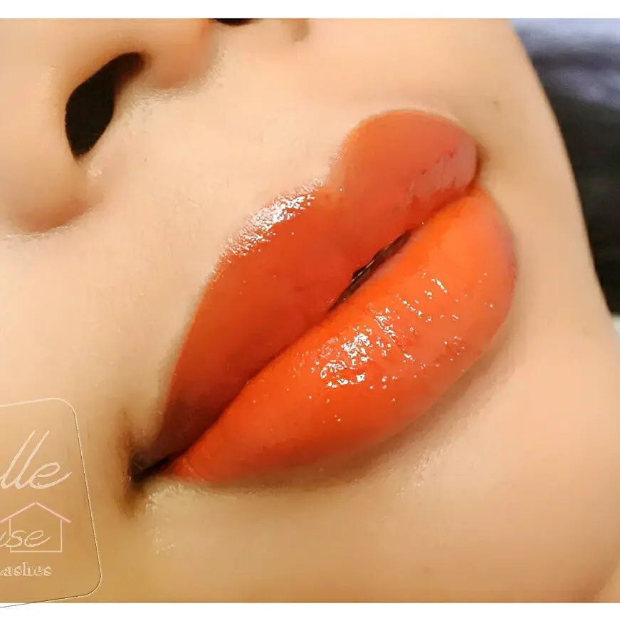 Treatment Sulam Bibir