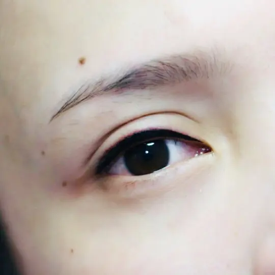 Treatment Sulam Eyeliner